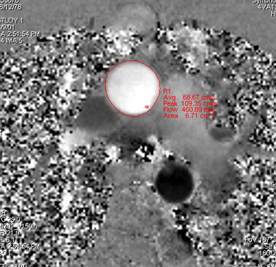 자기공명영상 (MRI, magnetic resonance image)