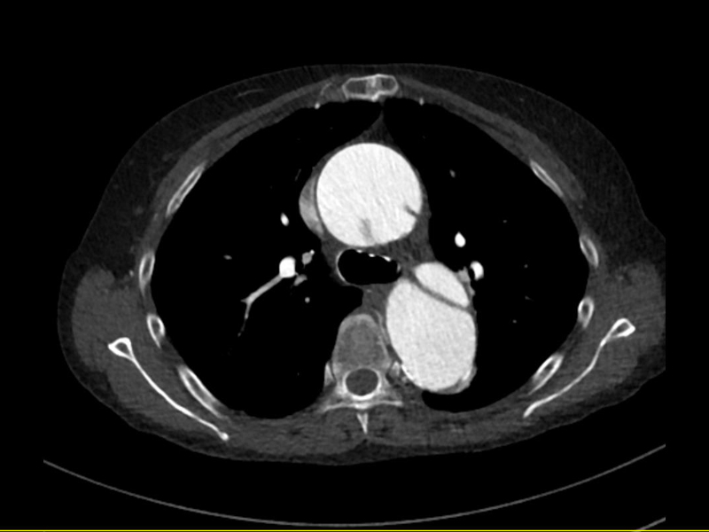 초음파 검사 (Ultrasonography)