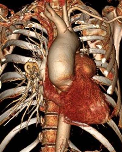 초음파 검사 (Ultrasonography)