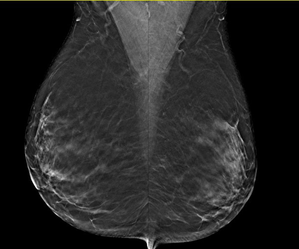 자기공명영상 (MRI)
