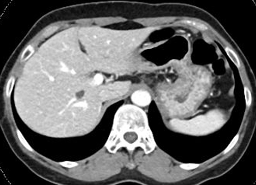 컴퓨터단층촬영 (CT, computed tomography)