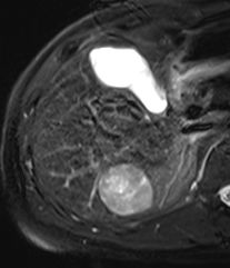 자기공명영상 (MRI, magnetic resonance image)