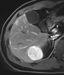 자기공명영상 (MRI, magnetic resonance image)