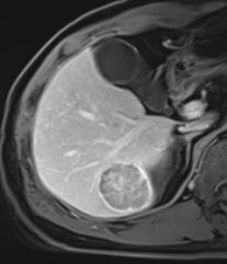 자기공명영상 (MRI, magnetic resonance image)