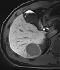 자기공명영상 (MRI, magnetic resonance image)