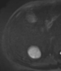 자기공명영상 (MRI, magnetic resonance image)