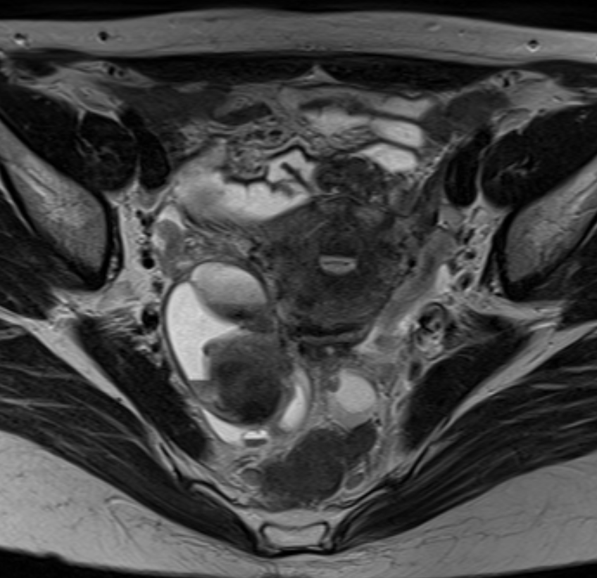자기공명영상 (MRI, magnetic resonance image)