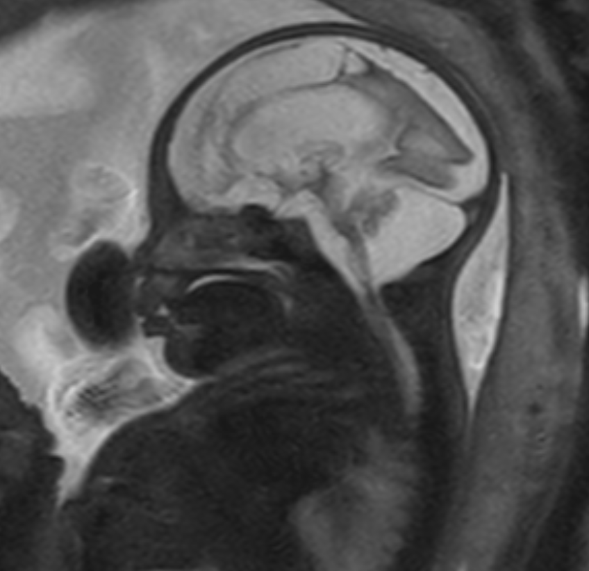 자기공명영상 (MRI, magnetic resonance image)