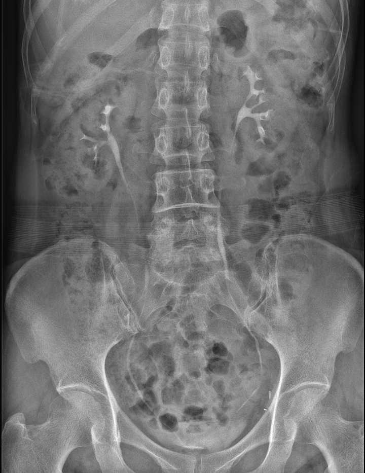 투시조영술 (Fluoroscopy)