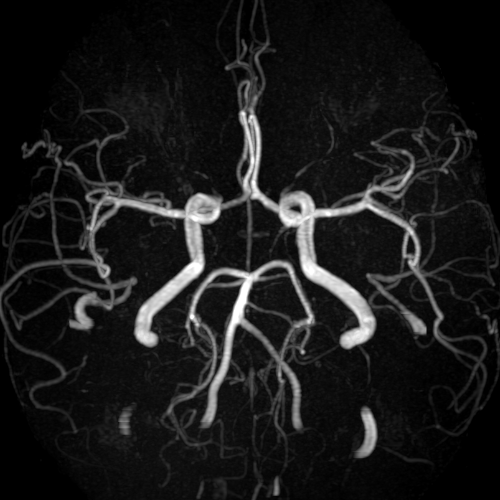 자기공명영상 (Magnetic Resonance Imaging: MRI)