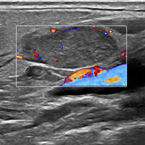 초음파촬영 (Ultrasonography)