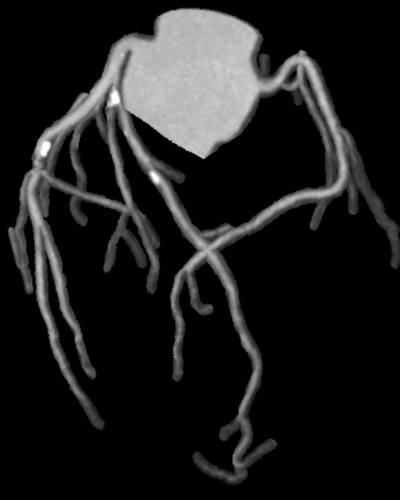 컴퓨터단층촬영 (CT, computed tomography)