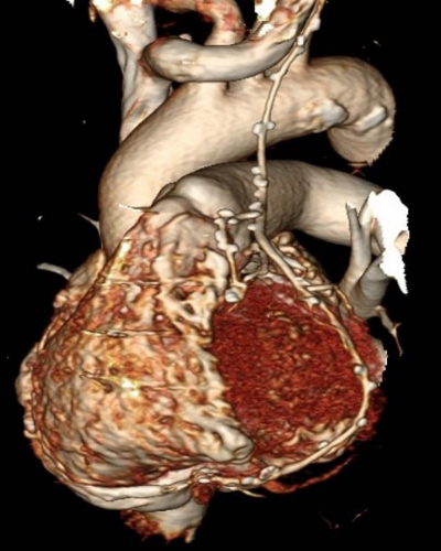 컴퓨터단층촬영 (CT, computed tomography)