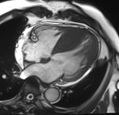 자기공명영상 (MRI, magnetic resonance image)